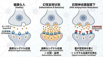 多巴胺与精神分裂症关系图解